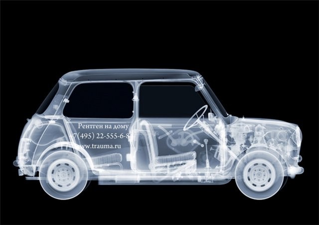 auto r-ray.jpg auto r-ray.jpg